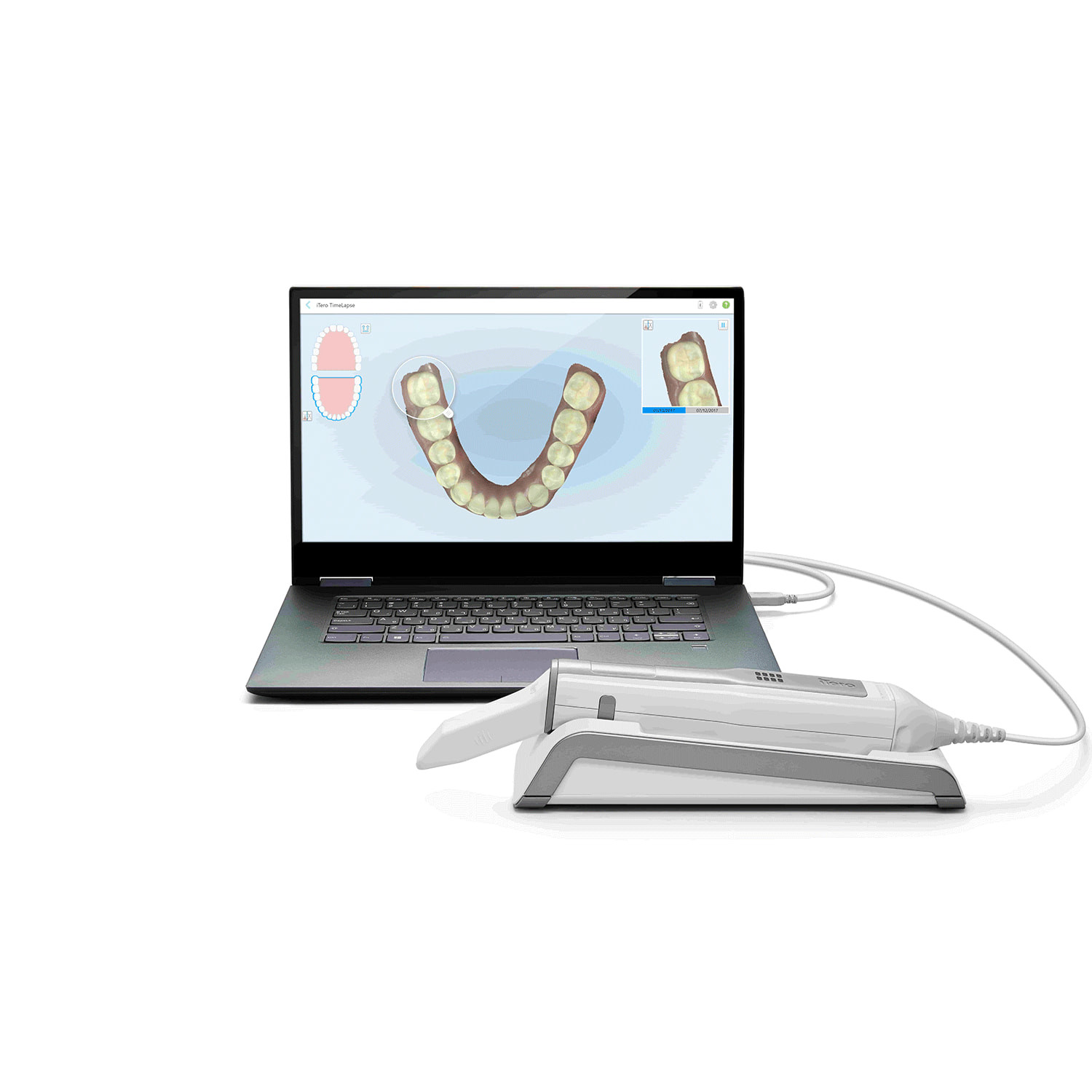 iTero Element 5D Intraoral Scanner (CPO)