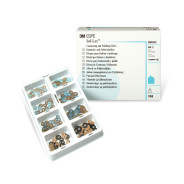 Sof-Lex Pop On Starter Kit - Blue 1980
