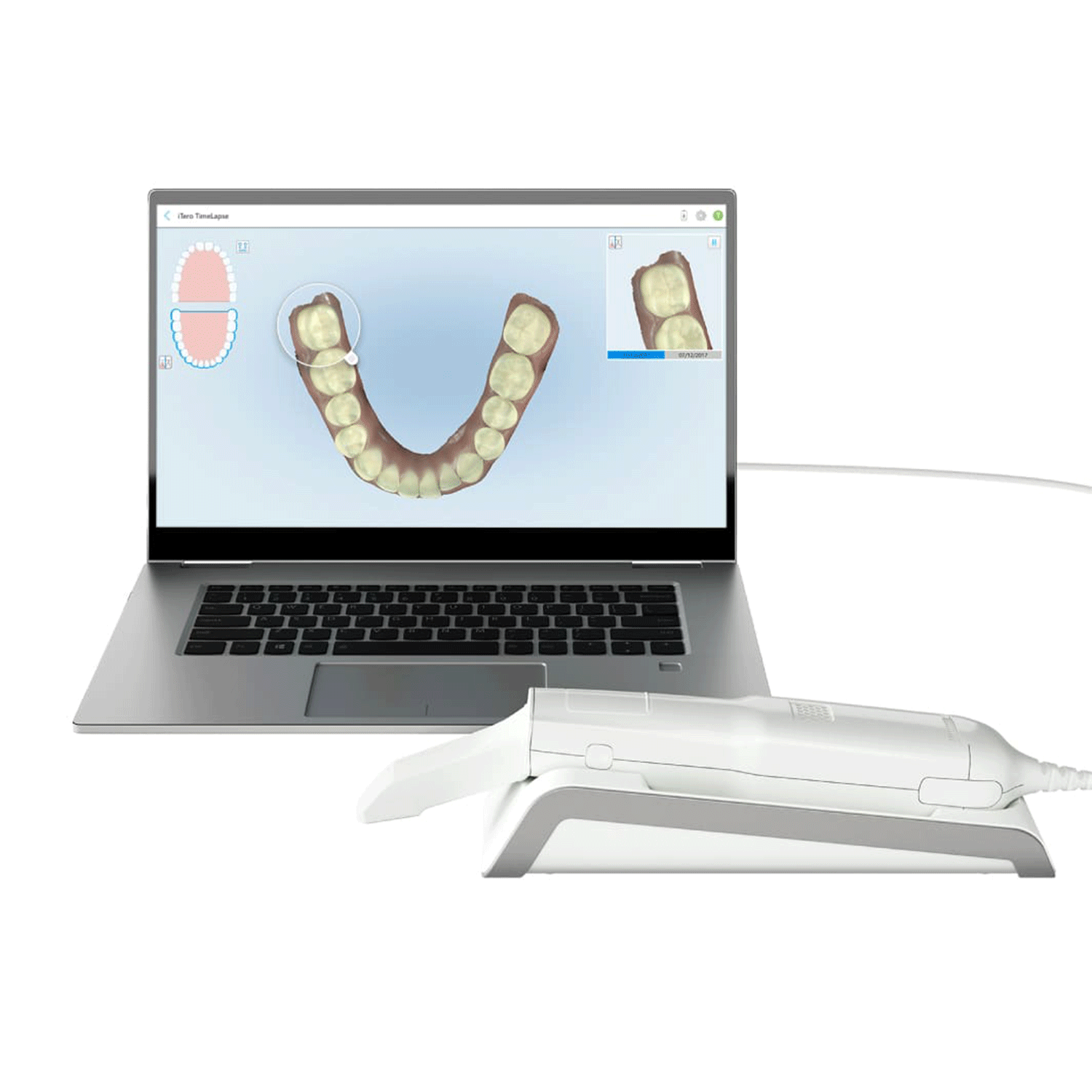 iTero Element Flex Intraoral Scanner (CPO) With Laptop